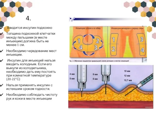 4. Вводится инсулин подкожно Толщина подкожной клетчатки между пальцами (в месте инъекции)