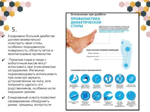 5. Ежедневно больной диабетом должен внимательно осмотреть свои стопы, особенно подошвенную поверхность,