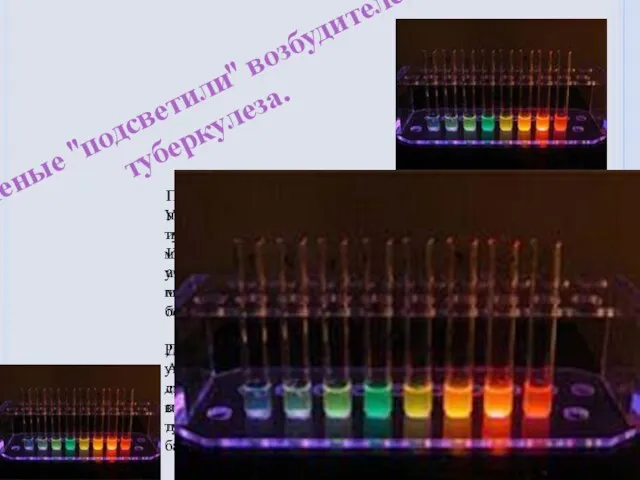 Ученые "подсветили" возбудителей туберкулеза. Ученые разработали методику ускоренной диагностики туберкулеза и выделения