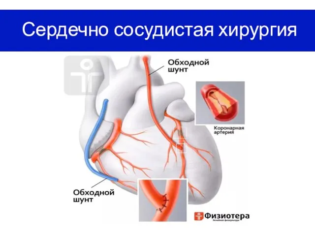 Сердечно сосудистая хирургия