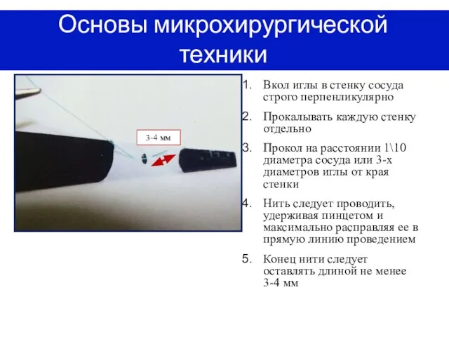 Основы микрохирургической техники Вкол иглы в стенку сосуда строго перпенликулярно Прокалывать каждую