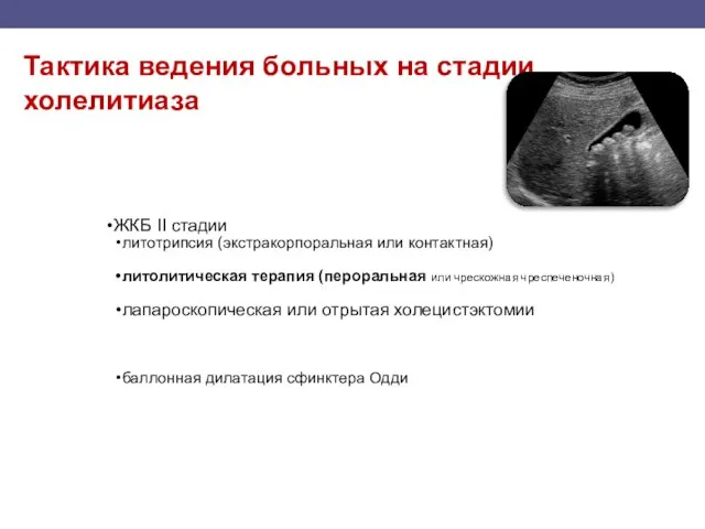 Тактика ведения больных на стадии холелитиаза ЖКБ II стадии литотрипсия (экстракорпоральная или