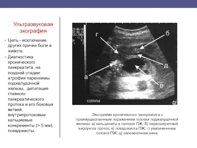 Ультразвуковая эхография Цель - исключение других причин боли в животе. Диагностика хронического