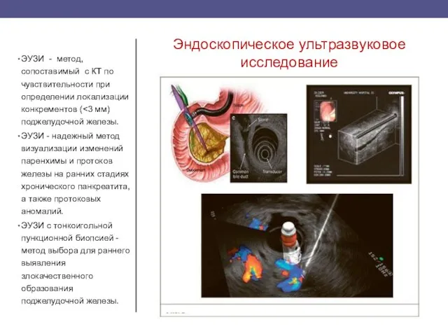 Эндоскопическое ультразвуковое исследование ЭУЗИ - метод, сопоставимый с КТ по чувствительности при