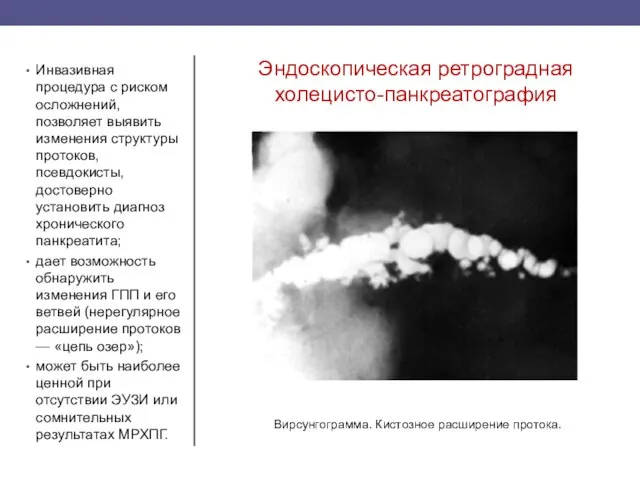 Эндоскопическая ретроградная холецисто-панкреатография Инвазивная процедура с риском осложнений, позволяет выявить изменения структуры