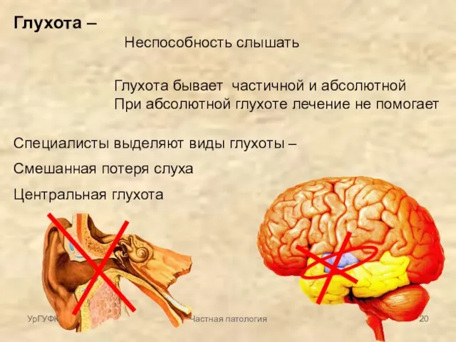 Глухота – Неспособность слышать Глухота бывает частичной и абсолютной При абсолютной глухоте