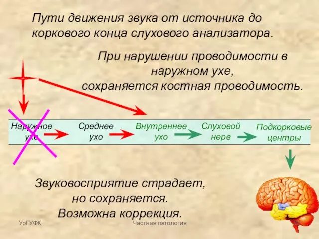 Пути движения звука от источника до коркового конца слухового анализатора. Наружное ухо