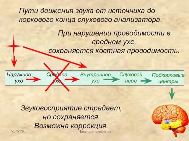 Пути движения звука от источника до коркового конца слухового анализатора. Наружное ухо