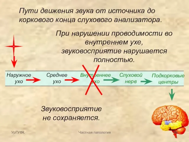 Пути движения звука от источника до коркового конца слухового анализатора. Наружное ухо