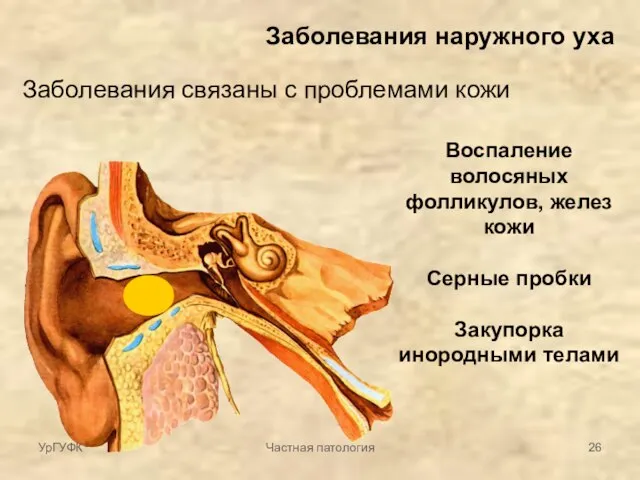 Заболевания наружного уха Заболевания связаны с проблемами кожи Воспаление волосяных фолликулов, желез