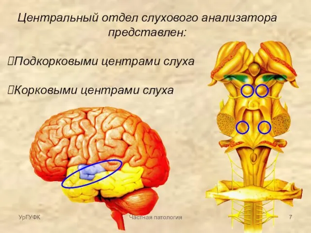Центральный отдел слухового анализатора представлен: Подкорковыми центрами слуха Корковыми центрами слуха УрГУФК Частная патология