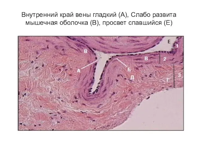Внутренний край вены гладкий (А), Слабо развита мышечная оболочка (В), просвет спавшийся (Е)