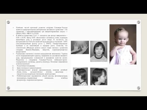 Наиболее частой причиной развития синдрома Сильвера–Рассела является однородительская (материнская) дисомия по хромосоме