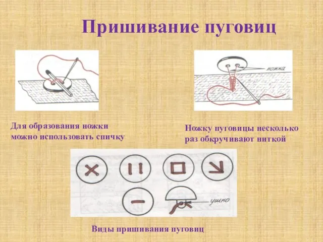 Пришивание пуговиц Для образования ножки можно использовать спичку Ножку пуговицы несколько раз