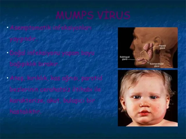 MUMPS VİRUS Asemptomatik infeksiyonları yaygındır. Doğal infeksiyonu yaşam boyu bağışıklık bırakır. Ateş,