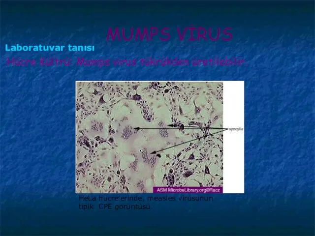 Hücre Kültrü: Mumps virus tükrükden üretilebilir. MUMPS VİRUS Laboratuvar tanısı HeLa hücrelerinde,