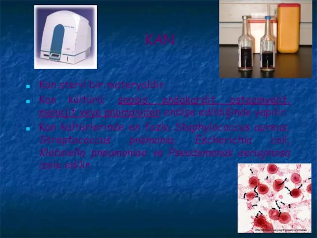 KAN Kan steril bir materyaldir. Kan kültürü; sepsis, endokardit, osteomyelit, menejit veya