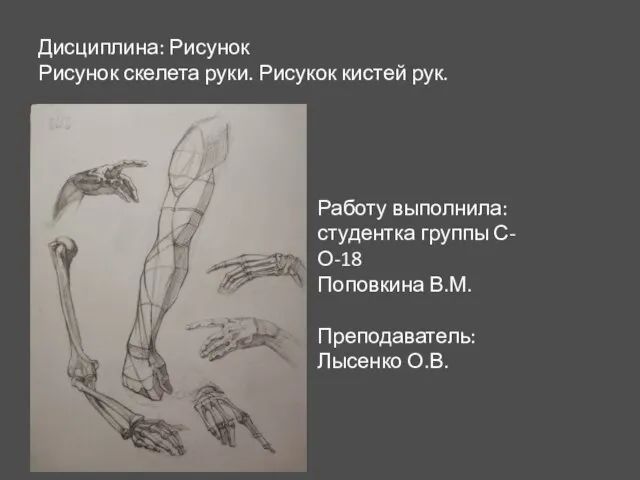 Дисциплина: Рисунок Рисунок скелета руки. Рисукок кистей рук. Работу выполнила: студентка группы