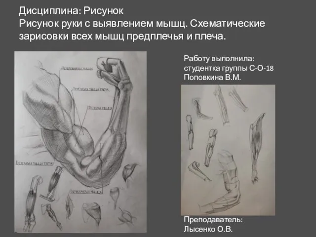 Дисциплина: Рисунок Рисунок руки с выявлением мышц. Схематические зарисовки всех мышц предплечья