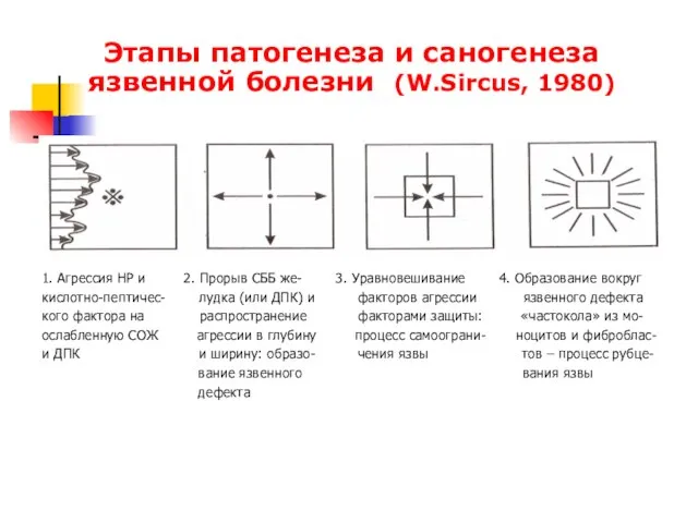 1. Агрессия НР и 2. Прорыв СББ же- 3. Уравновешивание 4. Образование