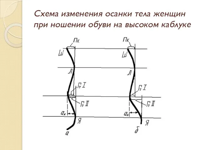 Схема изменения осанки тела женщин при ношении обуви на высоком каблуке