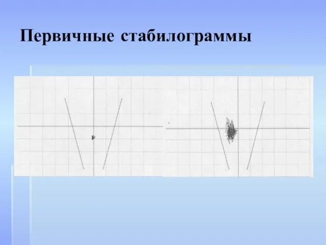 Первичные стабилограммы