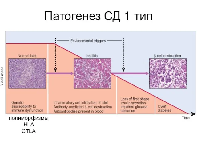 Патогенез СД 1 тип полиморфизмы HLA CTLA