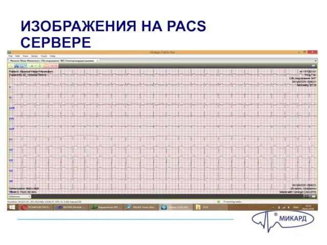 ИЗОБРАЖЕНИЯ НА PACS СЕРВЕРЕ