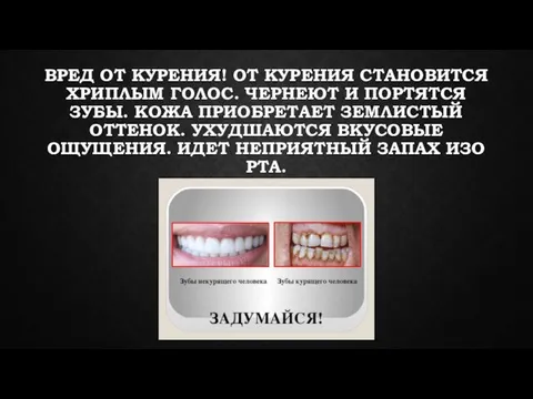 ВРЕД ОТ КУРЕНИЯ! ОТ КУРЕНИЯ СТАНОВИТСЯ ХРИПЛЫМ ГОЛОС. ЧЕРНЕЮТ И ПОРТЯТСЯ ЗУБЫ.