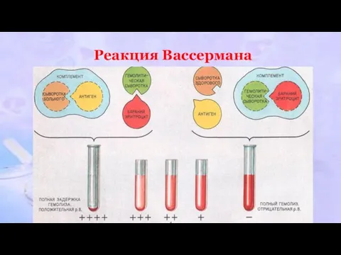 Реакция Вассермана