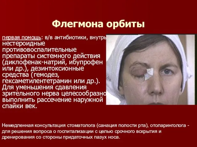 Флегмона орбиты первая помощь: в/в антибиотики, внутрь нестероидные противовоспалительные препараты системного действия