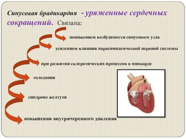 Синусовая брадикардия - уряженные сердечных сокращений. Связана: при развитии склеротических процессов в