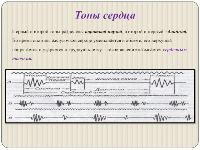 Тоны сердца Первый и второй тоны разделены короткой паузой, а второй и