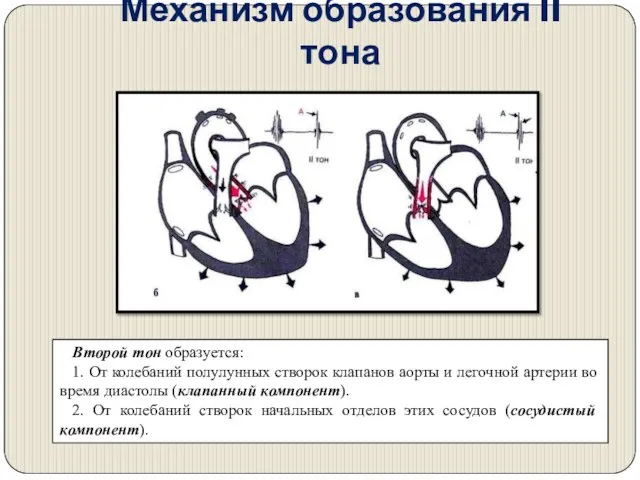 Механизм образования II тона Второй тон образуется: 1. От колебаний полулунных створок