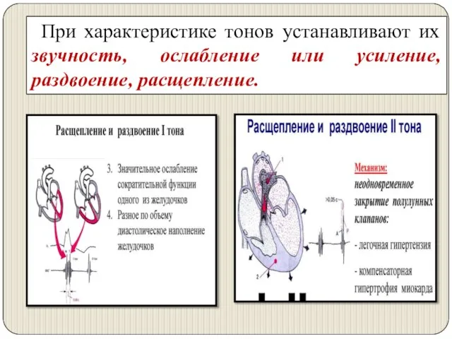 При характеристике тонов устанавливают их звучность, ослабление или усиление, раздвоение, расщепление.