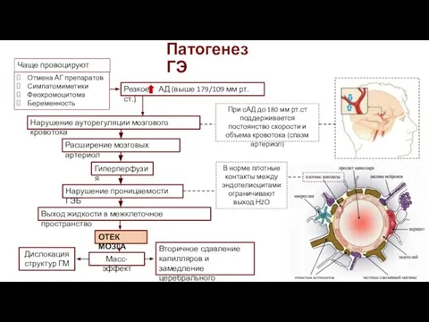 Патогенез ГЭ Отмена АГ препаратов Симпатомиметики Феохромоцитома Беременность Резкое АД (выше 179/109