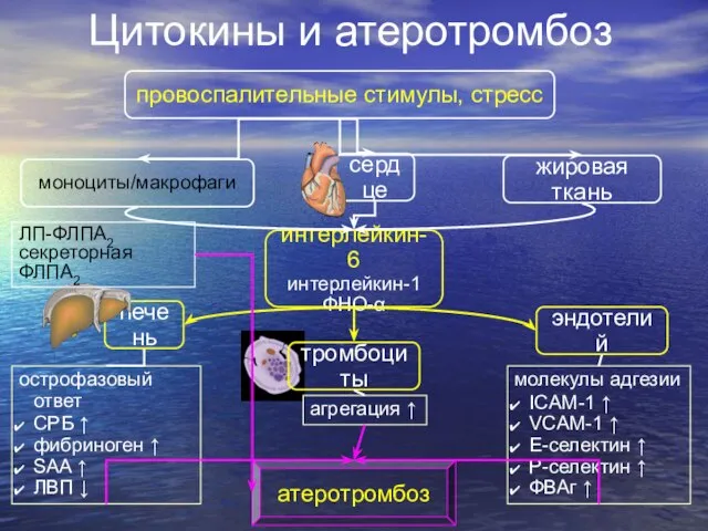 Цитокины и атеротромбоз провоспалительные стимулы, стресс жировая ткань моноциты/макрофаги интерлейкин-6 интерлейкин-1 ФНО-α