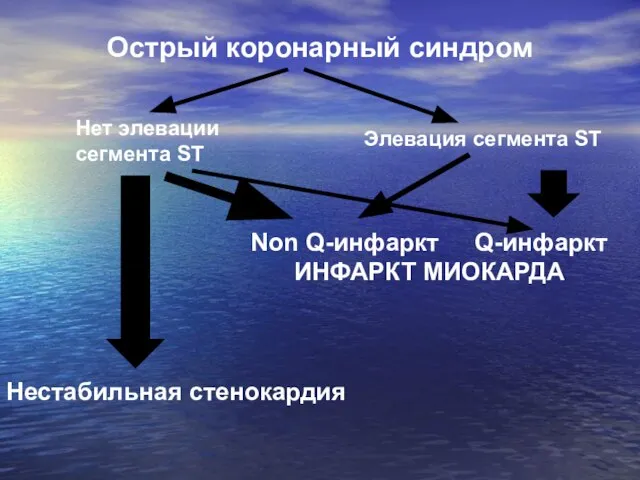 Острый коронарный синдром Нет элевации сегмента ST Элевация сегмента ST Нестабильная стенокардия