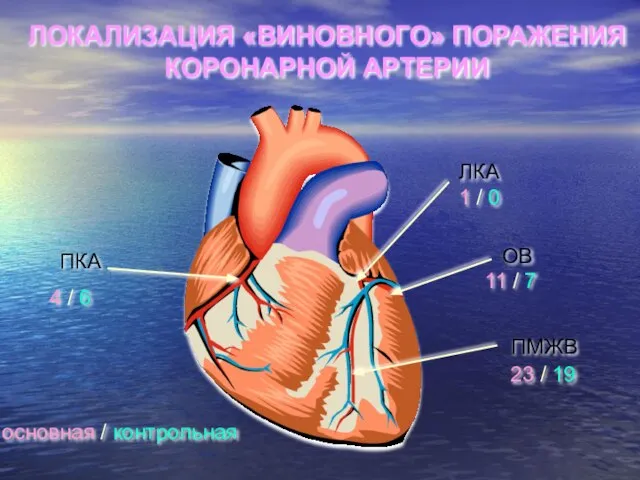 ПКА ЛКА ПМЖВ ОВ 4 / 6 1 / 0 11 /