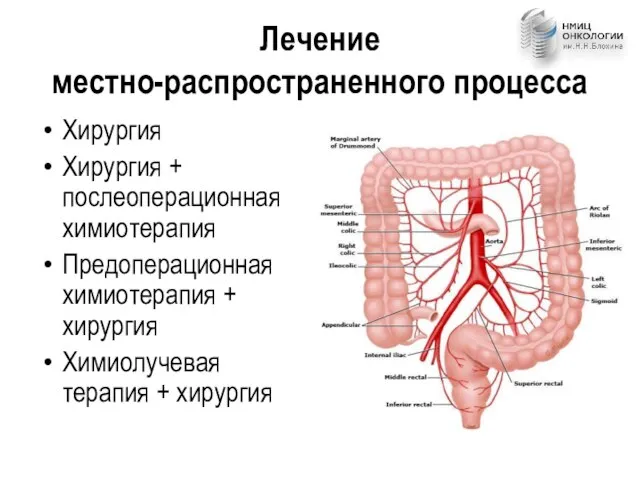 Лечение местно-распространенного процесса Хирургия Хирургия + послеоперационная химиотерапия Предоперационная химиотерапия + хирургия Химиолучевая терапия + хирургия