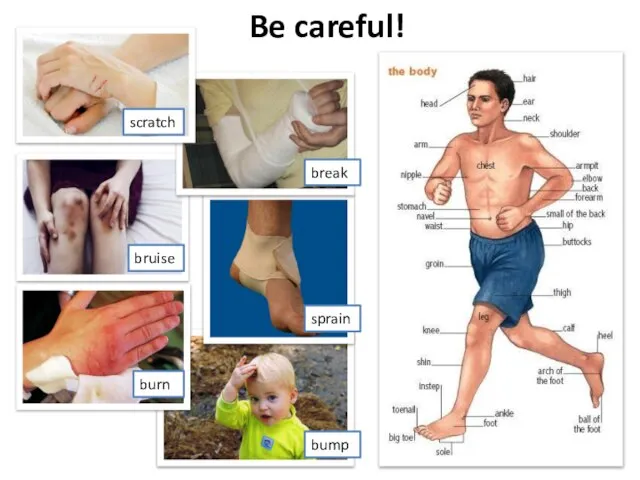 Be careful! scratch bruise burn break sprain bump