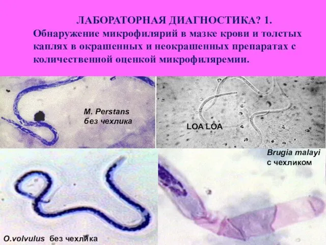 O.volvulus без чехлика Brugia malayi с чехликом LOA LOA M. Perstans без