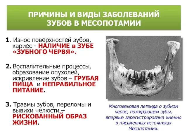 1. Износ поверхностей зубов, кариес - НАЛИЧИЕ в ЗУБЕ «ЗУБНОГО ЧЕРВЯ». 2.