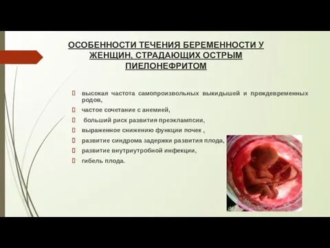 ОСОБЕННОСТИ ТЕЧЕНИЯ БЕРЕМЕННОСТИ У ЖЕНЩИН, СТРАДАЮЩИХ ОСТРЫМ ПИЕЛОНЕФРИТОМ высокая частота самопроизвольных выкидышей