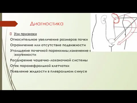 Диагностика Узи признаки Относительное увеличение размеров почки Ограничение или отсутствие подвижности Утолщение