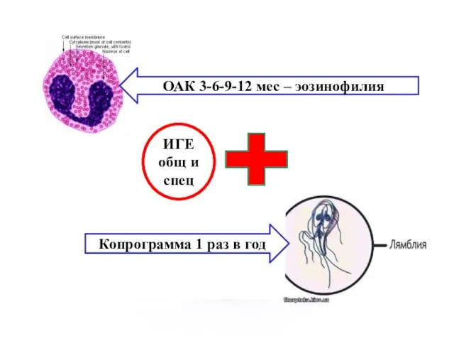 ИГЕ общ и спец ОАК 3-6-9-12 мес – эозинофилия Копрограмма 1 раз в год