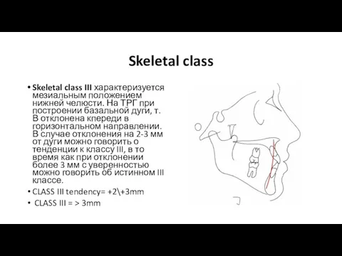 Skeletal class Skeletal class III характеризуется мезиальным положением нижней челюсти. На ТРГ