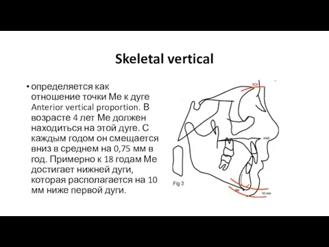 Skeletal vertical определяется как отношение точки Ме к дуге Anterior vertical proportion.