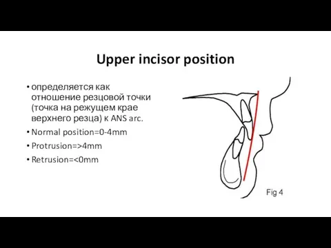 Upper incisor position определяется как отношение резцовой точки (точка на режущем крае