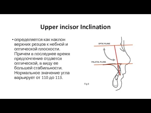 Upper incisor Inclination определяется как наклон верхних резцов к небной и оптической
